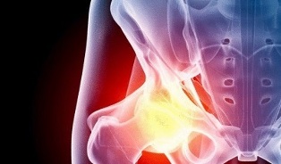 causes of development of hip osteoarthritis