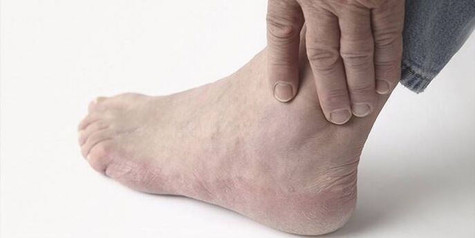 pain in the ankle arthrosis