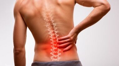 Signs and symptoms of lumbar spine osteochondrosis
