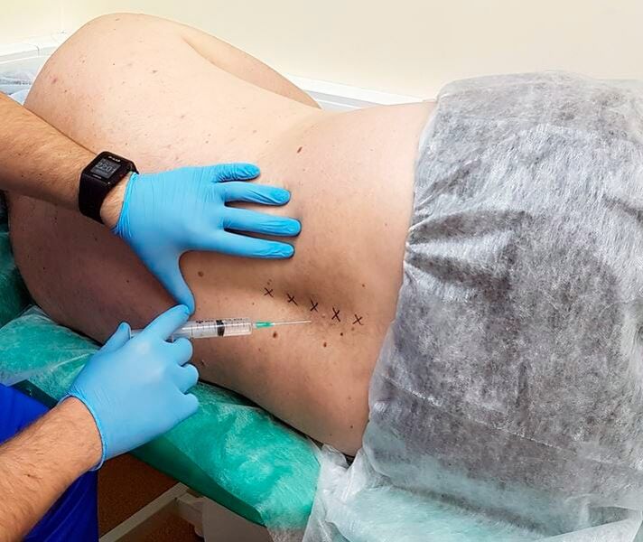 medicinal block for the back